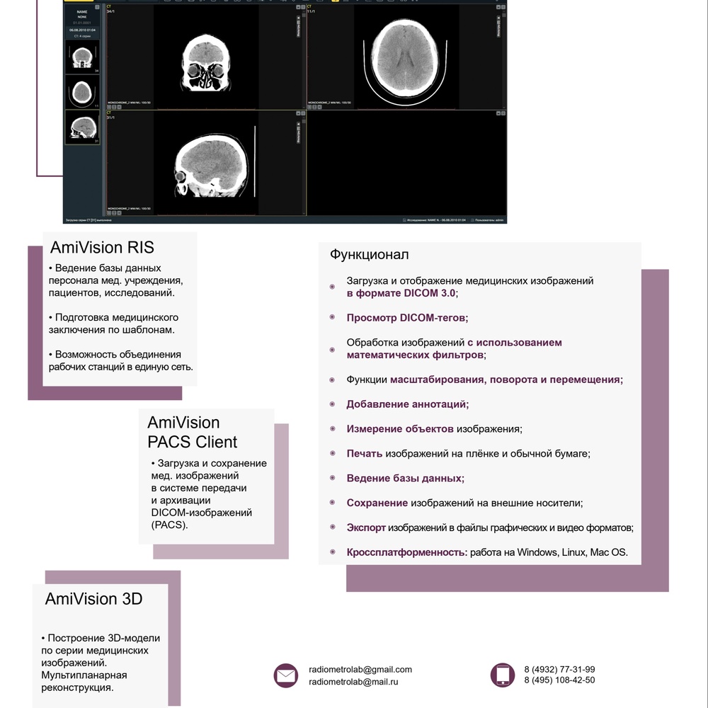 AmiVision - универсальный Dicom-просмотрщик