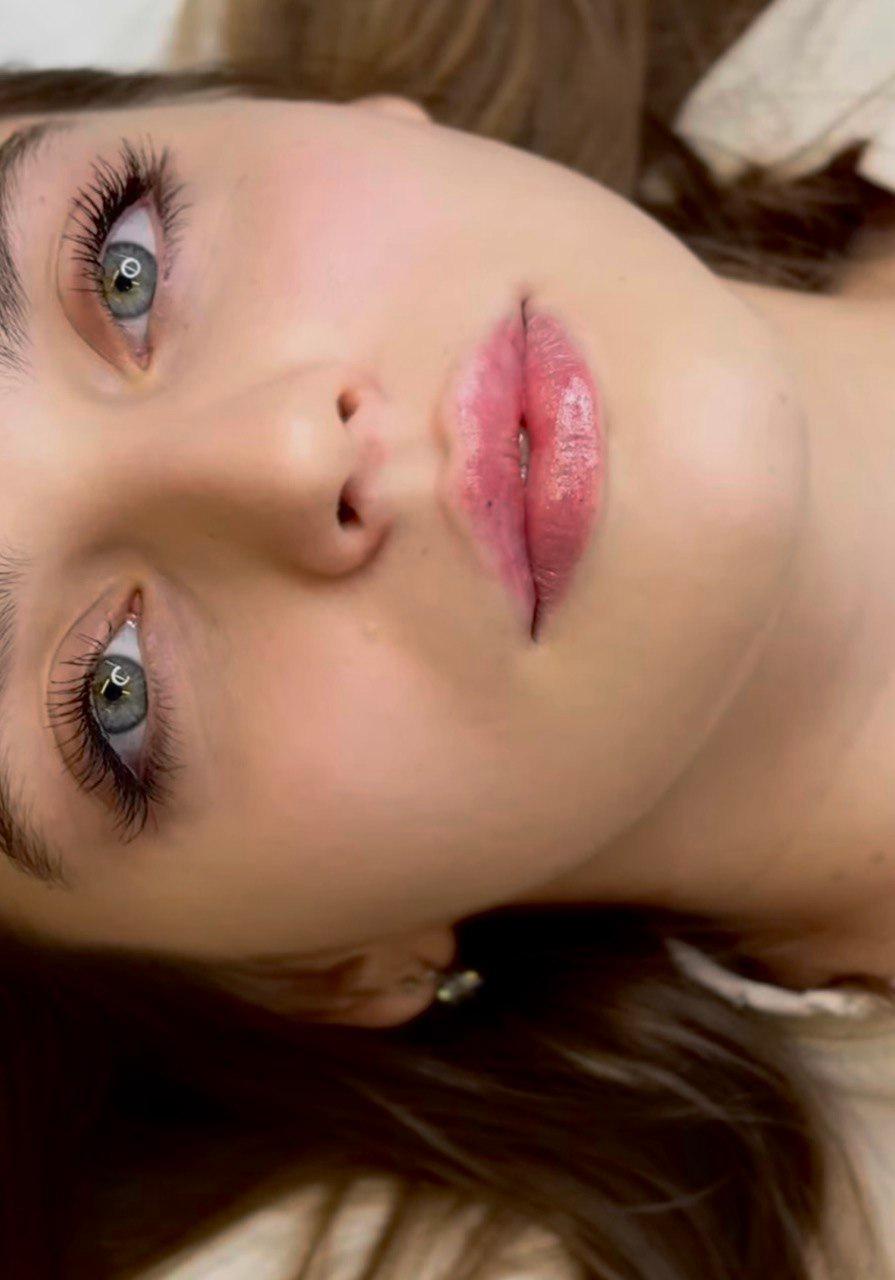 Контурная пластика губ