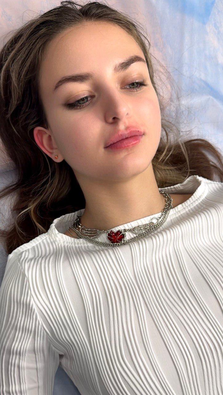 Контурная пластика губ