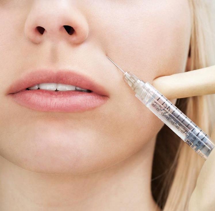 Контурная пластика носогубных складок