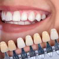 Выбор коронок