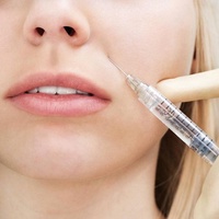 Контурная пластика носогубных складок