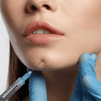 Контурная пластика подбородка 