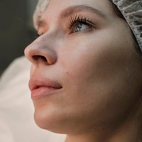 Контурная пластика щек