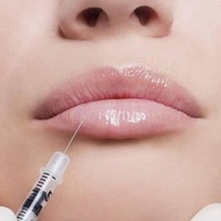 Контурная пластика губ