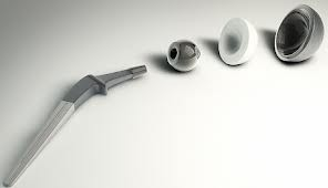 Эндопротезирование