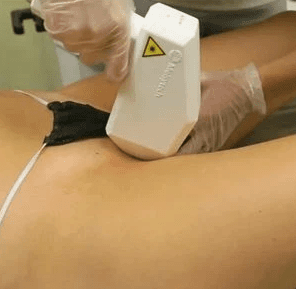 Бикини глубокое