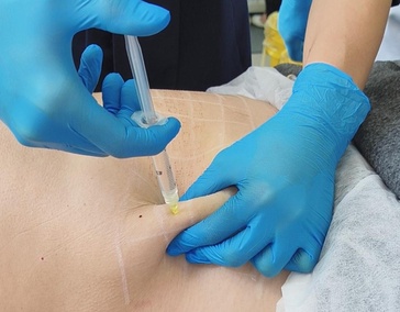 Коррекция фигуры