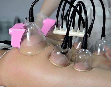 Ваккумный массаж