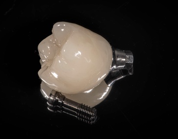 Одиночная коронка 