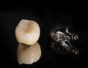 Индивидуальный абатмент