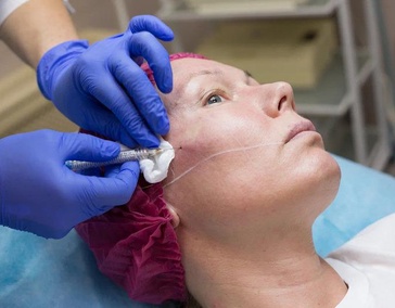 Коллагенотерапия