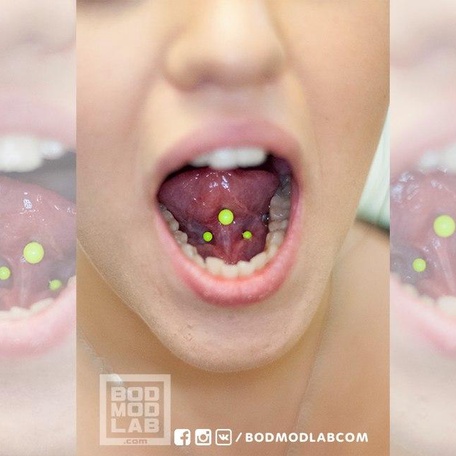 FRENULUM
